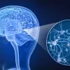 Esclerose m�ltipla: condi��o complexa para m�dicos e pacientes afeta milhares de pessoas no pa�s