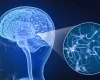 Esclerose m�ltipla: condi��o complexa para m�dicos e pacientes afeta milhares de pessoas no pa�s