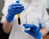 Cl�nicas suspendem coleta de plasma ap�s morte de dois doadores