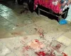 Mulher esfaqueia o marido ap�s ser agredida em briga por ci�mes