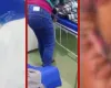 Adolescente encontra larvas em ferida ap�s cirurgia em MT; conselho investiga