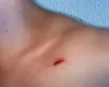 Mulher detida por ferir homem com faca em briga em Barra do Gar�as