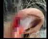 Neto arranca peda�o da orelha da av� e confessa que engoliu