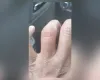 Ladr�o morde motorista de t�xi para roubar alian�a perto de batalh�o da PM no Rio