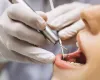 Cientistas da USP criam IA que detecta c�ries em radiografias dent�rias