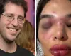 Dentista conta como sofria agress�es e amea�as do marido, que est� preso