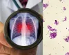 Morte em laborat�rio na R�ssia reacende alerta para peste pneum�nica