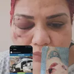 Funcionária de hospital relata momentos de acidente fatal em Sumaré