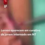 Adolescente encontra larvas em ferida após cirurgia em MT; conselho investiga