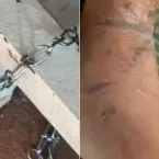 Neto arranca pedaço da orelha da avó e confessa que engoliu