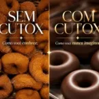 Procedimento estético inusitado: aplicação de botox no ânus divide opiniões