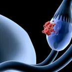 Oncologista avisa: evite 2 conservantes comuns em carnes para prevenir c�ncer