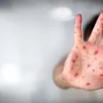 Vacinas contra gripe e covid s�o essenciais para proteger gestantes e beb�s, alertam m�dicos