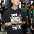 Travis Barker passa por cirurgia no braço e explica internação