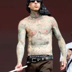 Travis Barker passa por cirurgia no braço e explica internação