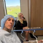 Travis Barker passa por cirurgia no braço e explica internação
