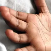 Menino de 11 anos morre ap�s comer bolo suspeito de envenenamento no Rio de Janeiro