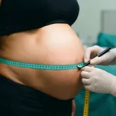 Abdominoplastia ap�s gravidez: mais que est�tica, corre��o da di�stase