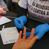 HIV: infec��es e mortes caem, mas falta de dinheiro amea�a o progresso