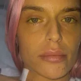 Viciada em drogas quase morre e fica com bexiga do tamanho de uma colher de ch�