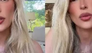 Yasmin Brunet revela segredos para vencer a depress�o: sono, comida e apoio s�o essenciais