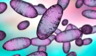 Alerta de Ebola global: Laborat�rio russo vaza bact�ria letal que causa a Peste