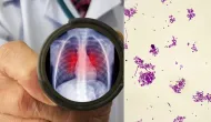 Morte em laborat�rio na R�ssia reacende alerta para peste pneum�nica