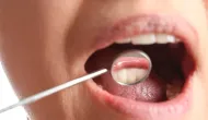 Por que seu t�rtaro volta t�o r�pido? Dentista revela o segredo da sua saliva
