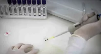 Exames negam ebola em imigrante do Congo