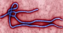 Surto de Ebola no Congo pode ser maior do que se pensa