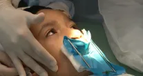 Tratamento de fissura no l�bio e c�u da boca precisa come�ar cedo e contar com v�rios especialistas