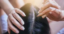 Arrancar cabelo branco faz nascer mais fios? Entenda o que dizem os especialistas