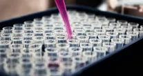 Exame de sangue simples pode detectar doen�as silenciosas