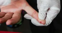Brasil bate meta e reduz transmiss�o de hepatite B de m�e para filho