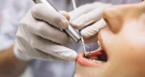Cientistas da USP criam IA que detecta c�ries em radiografias dent�rias