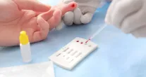 Estudo de Porto Alegre mostra atraso no diagn�stico de HIV entre heterossexuais casados