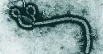 Congo testa vacina contra ebola em �rea mais cr�tica da epidemia