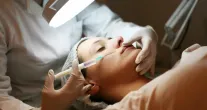 Sua idade define como o m�dico corrige o rosto na harmoniza��o facial