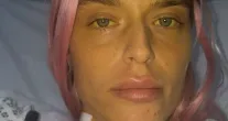 Viciada em drogas quase morre e fica com bexiga do tamanho de uma colher de ch�