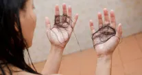 Por que meu cabelo cai mais com a troca de esta��o? Dermatologista responde