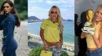 Virginia, Bruna Biancardi, Karoline Lima e mais: cirurgi�o analisa os procedimentos das musas que est�o dominando a Copa