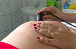 Teste para HTLV passa a ser indicado para gestantes durante pr-natal