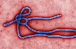 Novo surto de ebola atinge a República Democrática do Congo