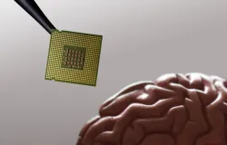 Musk quer acelerar procedimento para colocar 'chips' em c�rebros humanos