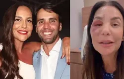 Ex-marido de Ivete fala sobre a cirurgia da cantora: 'Mulher de a�o'