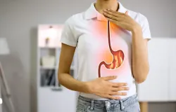 M�dicos revelam os piores alimentos para quem sofre de azia