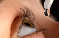 Compartilhar col�rio pode causar 4 doen�as nos olhos