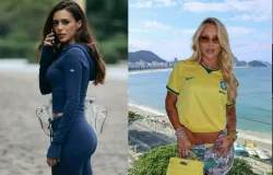 Virginia, Bruna Biancardi, Karoline Lima e mais: cirurgi�o analisa os procedimentos das musas que est�o dominando a Copa