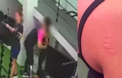 Instrutor de academia � denunciado por morder aluna e alega que foi brincadeira