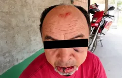 B�bado agride dono de bar ao n�o pagar conta e acaba sendo surrado